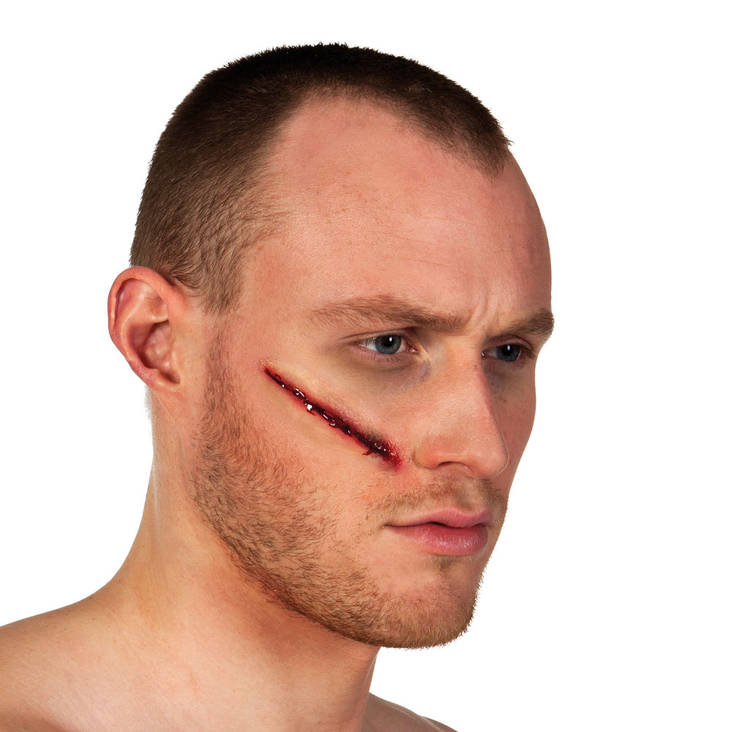 Aidonnäköinen arpi 2 - Arvet - 20236 - 1